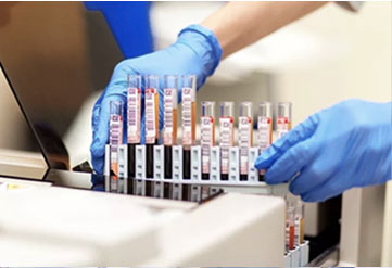 Diagnostic laboratory tests